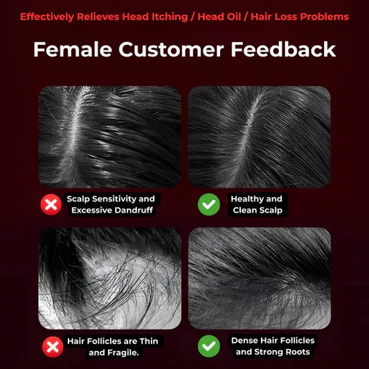 Smart Scalp Hair Massager